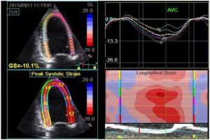 Definitely what an Echocardiogram (heart ultrasound) looks like - but not mine